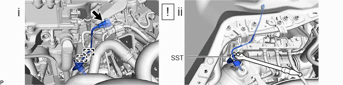 GTY1222485