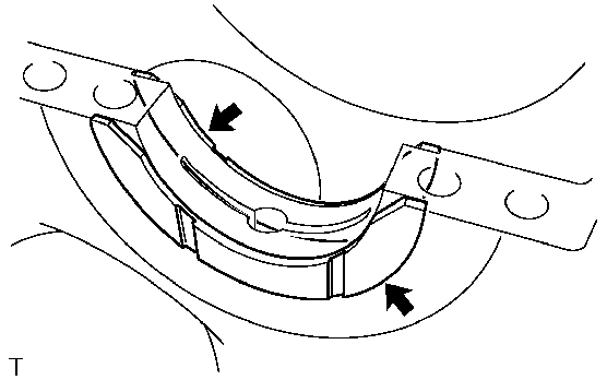 GTY125625